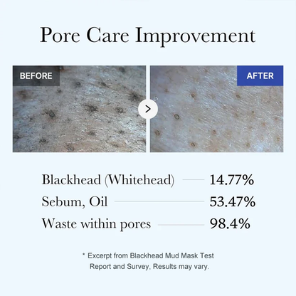 Zero Pores Blackhead Mud Mask-Free Pore Brush